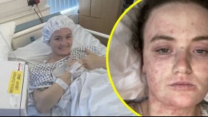 Tenía fuerte dolor de espalda, los doctores le dijeron 'dramática' y casi pierde la vida