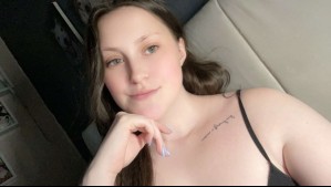 Fue al doctor por un sarpullido y le detectaron grave enfermedad: 'Esta batalla constante me ha quitado la vida'