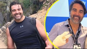 Actor Francisco López sufrió quemadura durante presentación en colegio: 'Siempre lo tomo por el lado positivo'