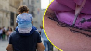 Insólito: Padres bielorrusos tatúan a su hijo de un año para participar en concurso de influencer