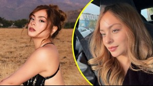 Skarleth Labra se realizó doble armonización facial a sus 20 años: Este fue el resultado de su retoque estético