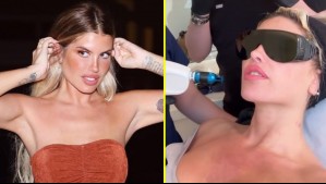 Coté López se realizó tratamiento estético en su rostro y pecho: En esto consiste