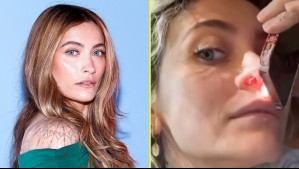 Paris Jackson revela brutal secuela en su nariz producto del consumo de drogas: 'Tengo el tabique perforado'