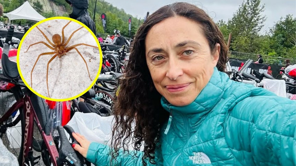 Deportista chilena terminó en la UCI tras picadura de una araña de rincón: 'Estuve a punto de perder el brazo'