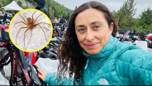Deportista chilena terminó en la UCI tras picadura de una araña de rincón: 'Estuve a punto de perder el brazo'