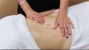 ISP emite alerta por venta de parches para 'bajar de peso' sin registro sanitario: ¿Cuáles son sus riesgos?