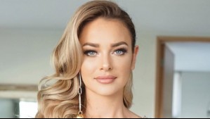 Daniela Nicolás revela diagnóstico de enfermedad neurológica que recibió: 'Es una condición descubierta hace pocos años'