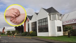 Preocupación por brote de varicela: 17 casos y dos estudiantes hospitalizados provocan suspensión de clases en colegio de Osorno