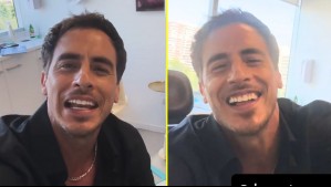 'Para que queden así de bellos como yo': Camilo Huerta mostró el novedoso tratamiento estético que se realizó