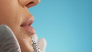 Puede causar parálisis facial y problemas para respirar: ISP advierte sobre los riesgos del uso de bótox sin control médico