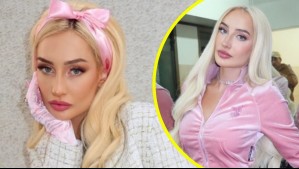 Fran Maira se sometió a llamativa intervención estética y mostró los resultados: 'Quedó increíble, una curva perfecta'