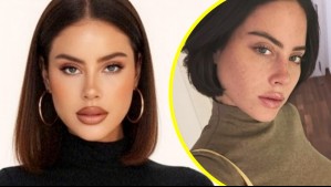 El antes y después de Ignacia Michelson tras tratamiento con ADN de salmón: 'Tenía mi carita muy dañada'