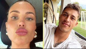 'Cortes profundos': Pololo de Coté López revela que estará un mes ausente por grave accidente