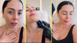 Daniela Aránguiz revela su 'primer regalo de Navidad' con un retoque estético: ¿Qué se hizo?