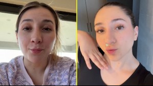 La compararon con Leonardo Farkas: Carlita Inostroza sorprende con procedimiento estético y se llena de críticas