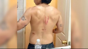 Cantante urbano sufrió fea lesión en su espalda tras caída desde altura en vísperas de Navidad