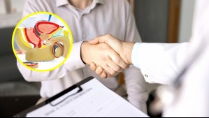 La vasectomía va en aumento en Chile: 'Si alguien se arrepiente, se puede revertir con buenas tasas de efectividad'