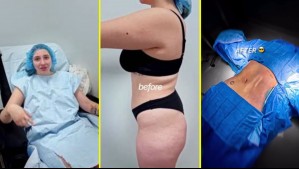 Carlita Inostroza muestra su radical cambio tras someterse a una cirugía: Así quedó la influencer