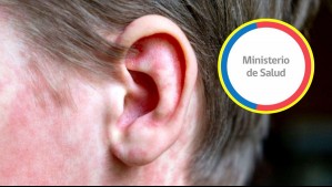 Alerta por caso importado de sarampión en Chile: ¿Cómo reconocer los síntomas?