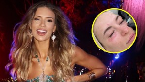 El antes y después de Julia Fernandes tras procedimiento estético en su rostro: Recibió críticas por usar filtros