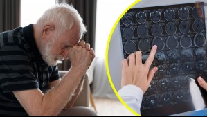 Científicos logran revertir el alzhéimer en ratones gracias a nuevo enfoque en investigación