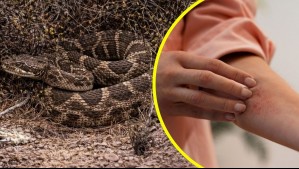 ¿Qué pasa si me muerde una serpiente cascabel? Los riesgos ante el ataque del reptil que fue avistado en San Antonio