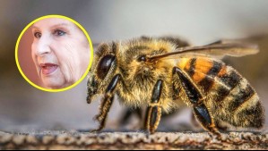 Picadura de abeja: ¿Qué hacer ante una reacción alérgica grave como la que sufrió la exprimera dama?