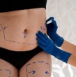 Los afiliados a Fonasa pueden comprar en cualquier momento un Bono PAD para abdominoplastia, un beneficio que cubre desde honorarios hasta postoperatorio por un precio fijo y conocido