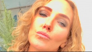 Catalina Pulido se sometió a tratamiento regenerativo y compartió los resultados: Mira el antes y el después