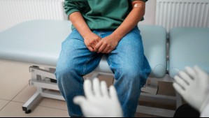 Bono PAD Vasectomía: ¿Cuánto paga el usuario?