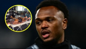 Delantero de la Juventus se viraliza tras someterse a terapia de ventosas: ¿Qué dicen los expertos?