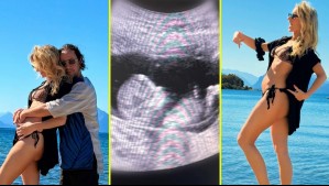 Actores Camilo Carmona y Silvanna Gajardo anuncian que serán padres con tiernas fotografías