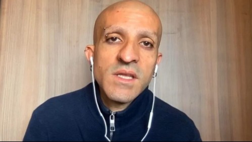 Atado de manos, rociado con bencina y rayado con consignas políticas: Lo que se sabe del brutal ataque que sufrió Rojas Vade