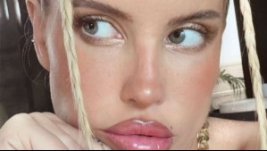 'Por eso el dolor incesante': Coté López revela su diagnóstico luego de estar varios días con un intenso malestar