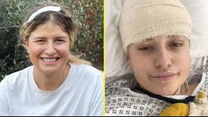 Cayó por las escaleras tras una noche de fiesta y pensó que era una conmoción: Le detectaron un tumor cerebral