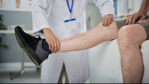 Bono PAD para intervención por várices: Este es el valor a pagar