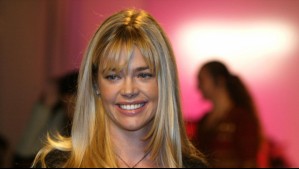 El sorprendente antes y después de la actriz Denise Richards luego de someterse a una cirugía estética
