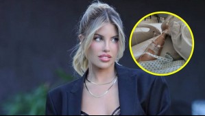 Cote López tuvo que operarse tras intensos dolores estomacales: Atravesó un delicado estado de salud previo a la cirugía