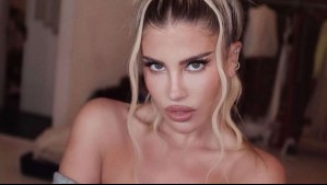 Bloqueo u obstrucción biliar: Revisa en qué consiste la enfermedad que sufrió Coté López