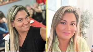 'Te sacaste 10 años': Denisse Campos impacta con su nueva apariencia física tras 6 cirugías