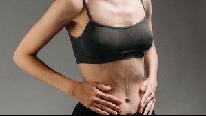 Bono Pad para Hernia abdominal: ¿Cuánto paga el usuario?