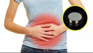 Alerta por reto viral que consiste en ingerir imanes: 7 adolescentes fueron operados de emergencia