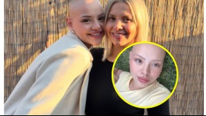 Hija de Nicole Pérez sobre trastorno alimenticio que la mantuvo hospitalizada: 'Quería visibilizar que existía'