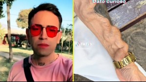 Chileno muestra cómo quedó su brazo tras grave problema en una muela: 'La infección se mueve, baja y se traga'