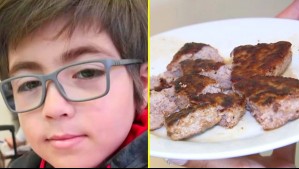 ¿Qué es la Escherichia coli?: Los peligros de la bactería que provocó muerte de niño tras comer hamburguesa cruda