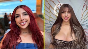 'Amarme no significa quedarme igual': Chilota muestra cambio de look tras cirugías estéticas