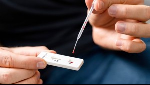 ISP emite alerta por test rápidos de VIH que se venden en Chile sin registro sanitario: 'Suspender su uso de inmediato'