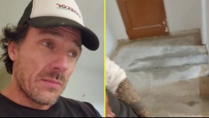 Gonzalo Egas sufre accidente doméstico tras realizar arreglos en su departamento: 'Me mandé la cag... del siglo'