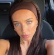 Erica Roberts, exparticipante de ?Casados a primera vista, advirtió que podría perder el olfato tras una rinoplastia. La influencer mostró su recuperación y relató las secuelas del procedimiento.
