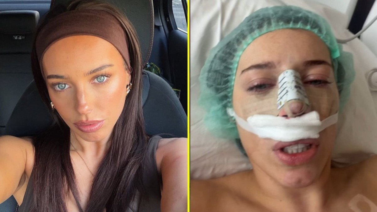 Exchica reality se sometió a cirugía nasal y podría perder el olfato: 'Me siento bastante deprimida'